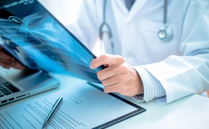 Public Health Cancer Study