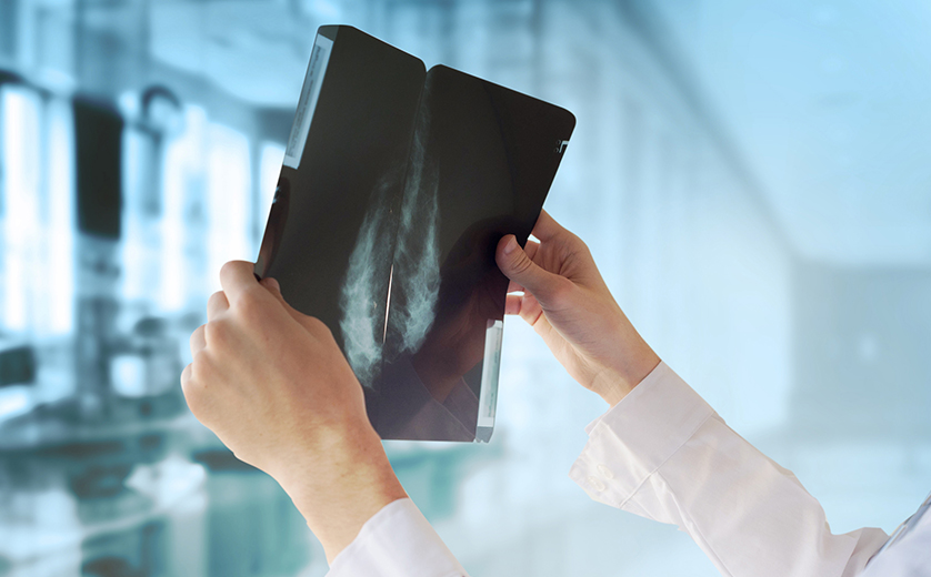 Surviving Breast Cancer